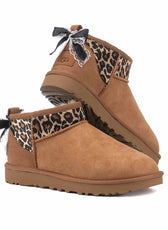 stivali UGG leopardati e dettagli in pizzo
